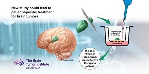 Collaboration with UNC could lead to personalized treatment for brain tumors